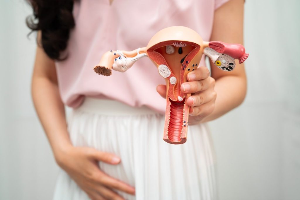 uterine-fibroids